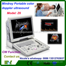 Z6 Mindray La fonction CW la plus avantageuse, la sonde à doppler couleur / l&#39;échographie Doppler couleur portable